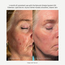Lipid Serum