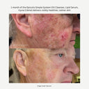 Lipid Serum