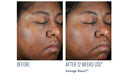 Even Intensive Skin Tone Correcting Serum